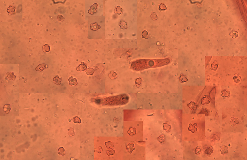 Sagaranella gibberosa spores